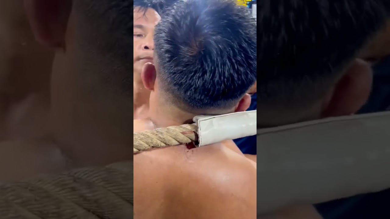 🔴หนุ่มเทศบาลVS🔵กำไลหยก #ต่อยกันมันมากที่สุรินทร์7มี.ค69