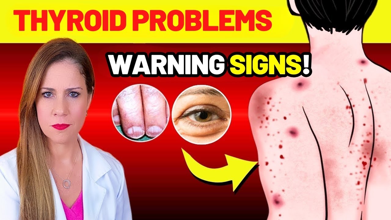 9 WARNING SIGNS Your THYROID is Begging for Help - 4 Mistakes That Destroy It