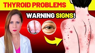 9 WARNING SIGNS Your THYROID is Begging for Help - 4 Mistakes That Destroy It