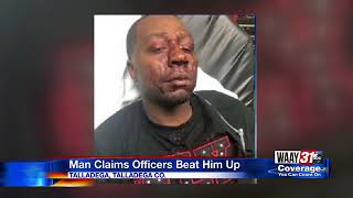Man Claims Officers Beat Him Up