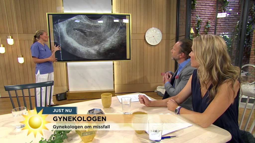 Gynekologen: 