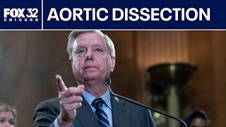 Aortic dissection: Warning signs after Sen. Lindsey Graham's death