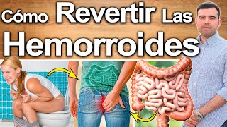 Cómo Curar Las Hemorroides Internas - Causas, Remedios Y Soluciones