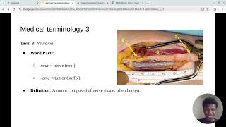 Medical Case Study: 54 year old man by Aly Kouyate