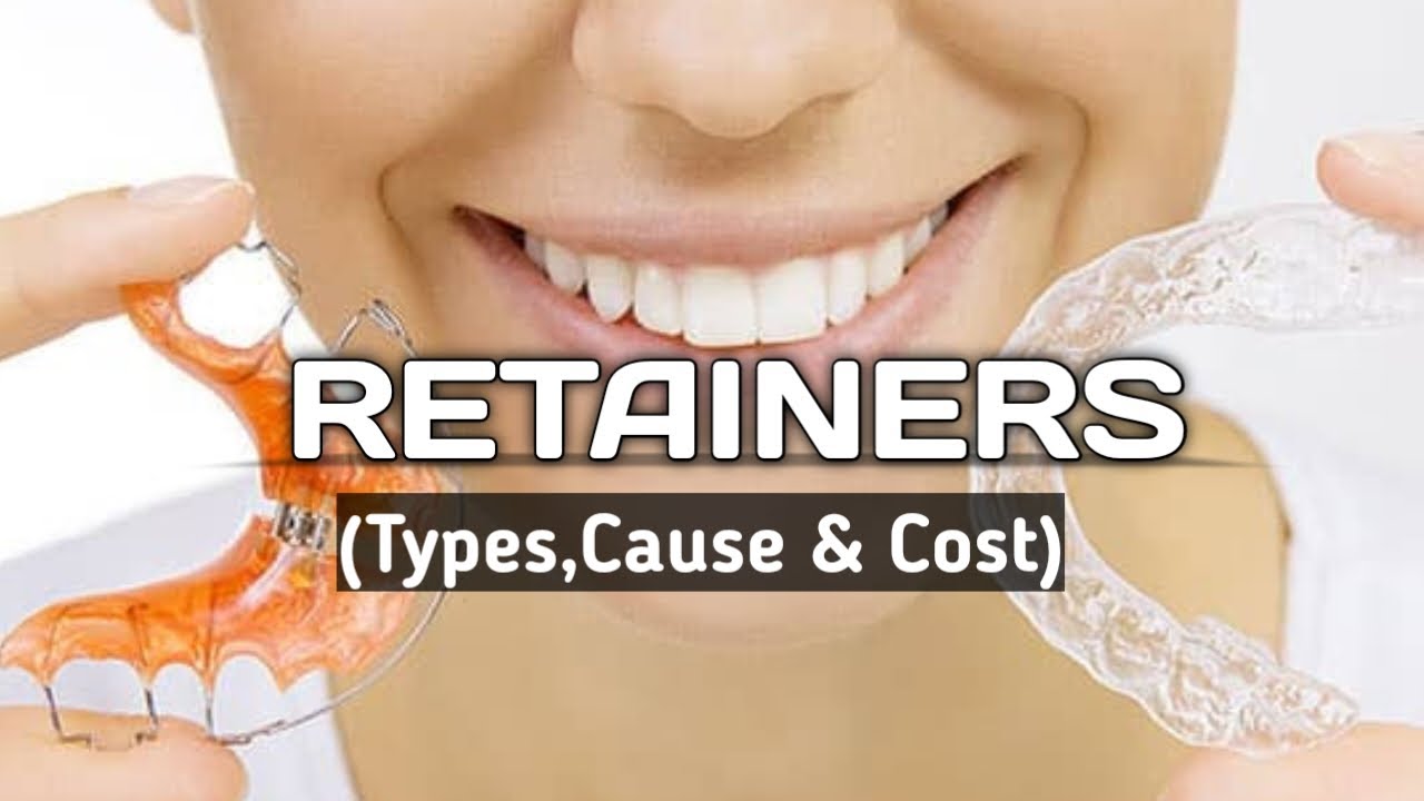 Why Retainer is necessary after removal of braces How it Works