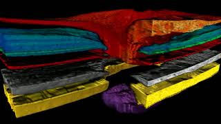 Segmented 3D Optic Nerve Head