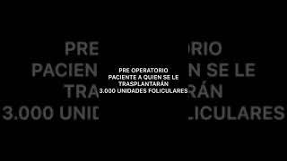 Técnica FUE, trasplante / injerto de cabello Caracas Venezuela