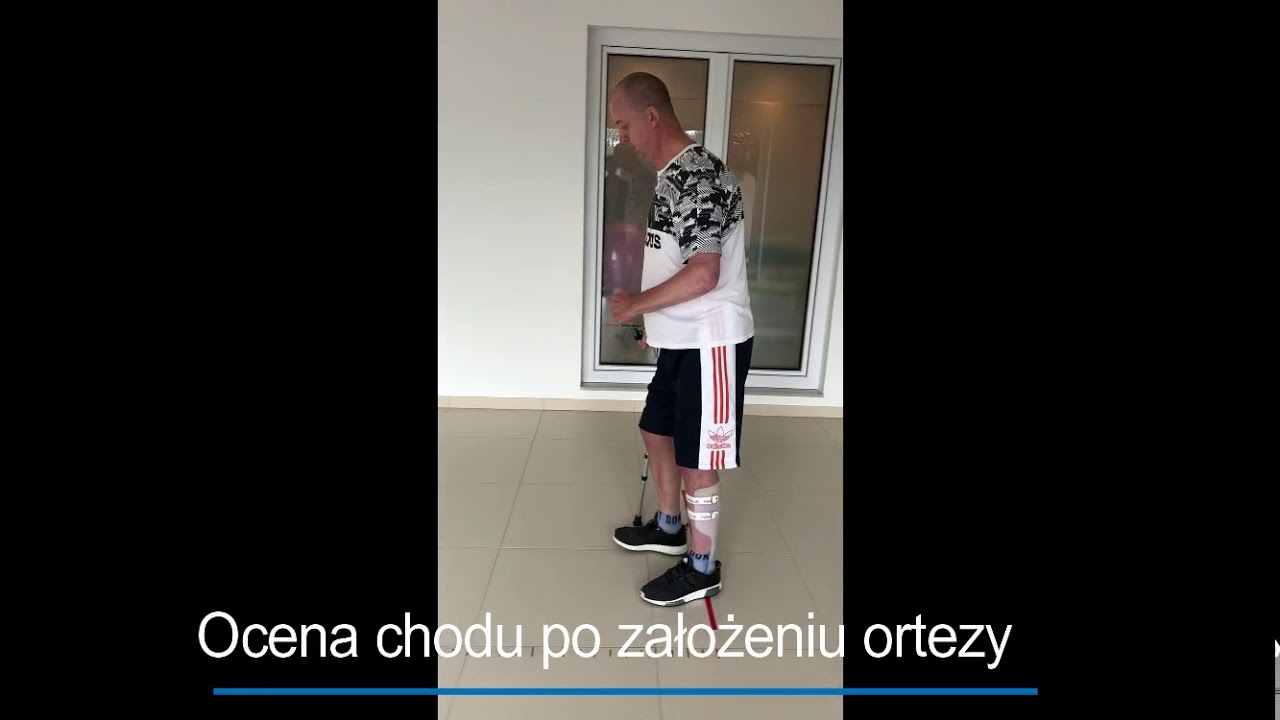 Jak poprawia chód orteza Habilis AFO u pacjenta 3 lata po udarze mózgu.