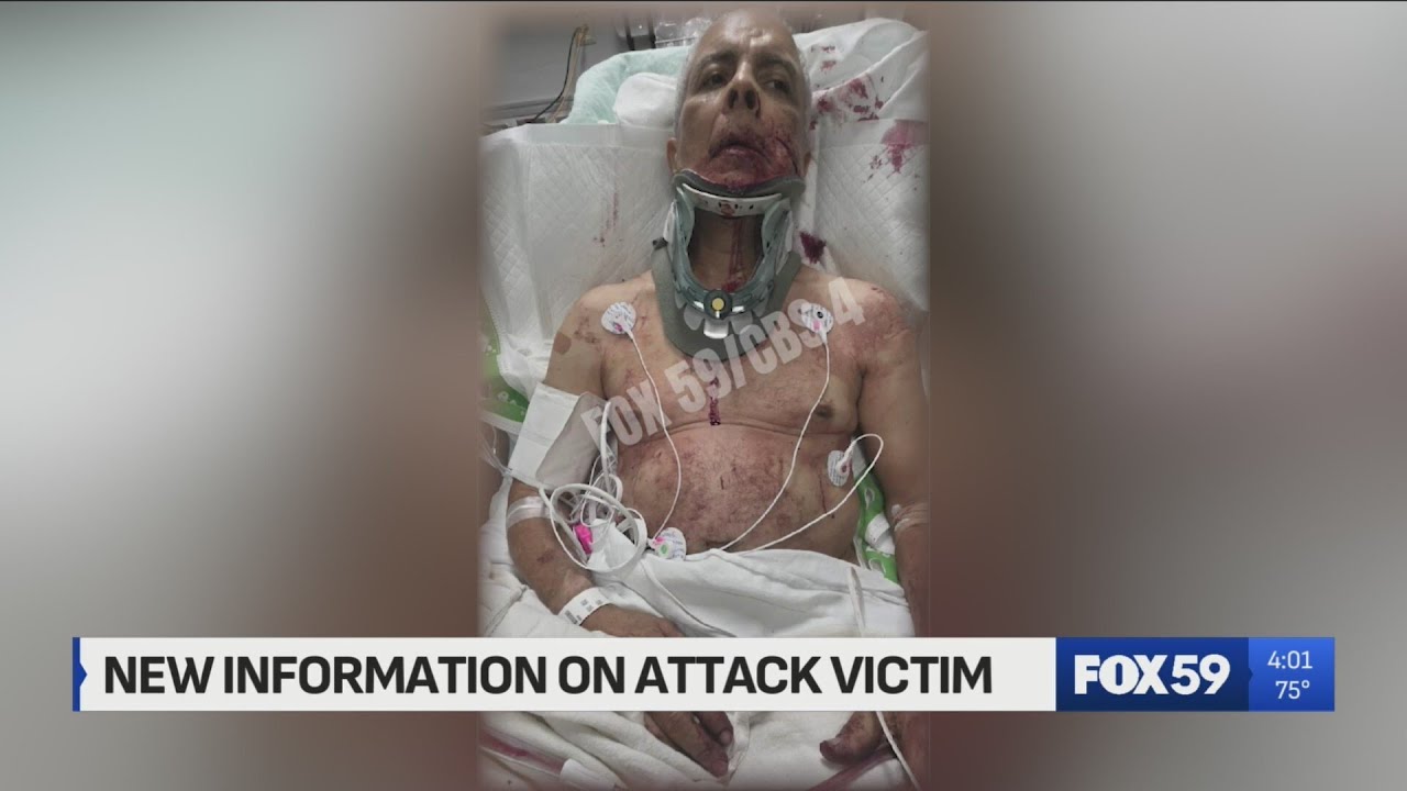 Ex-NFL QB Mark Sanchez’s alleged victim fights back in court