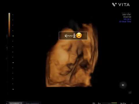 31주 입체초음파_도담이 하품영상♥