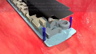 Animation   Endo GIA™ Reinforced Reload with Tri Staple™ Technology