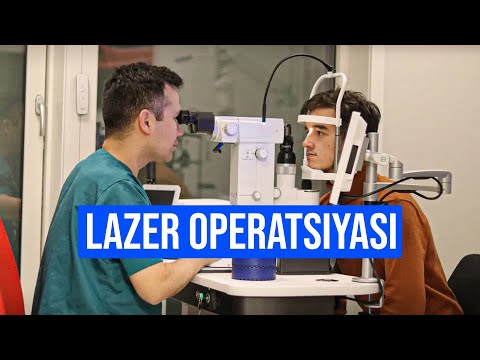 LASIk operatsiyasi qanday bajariladi?