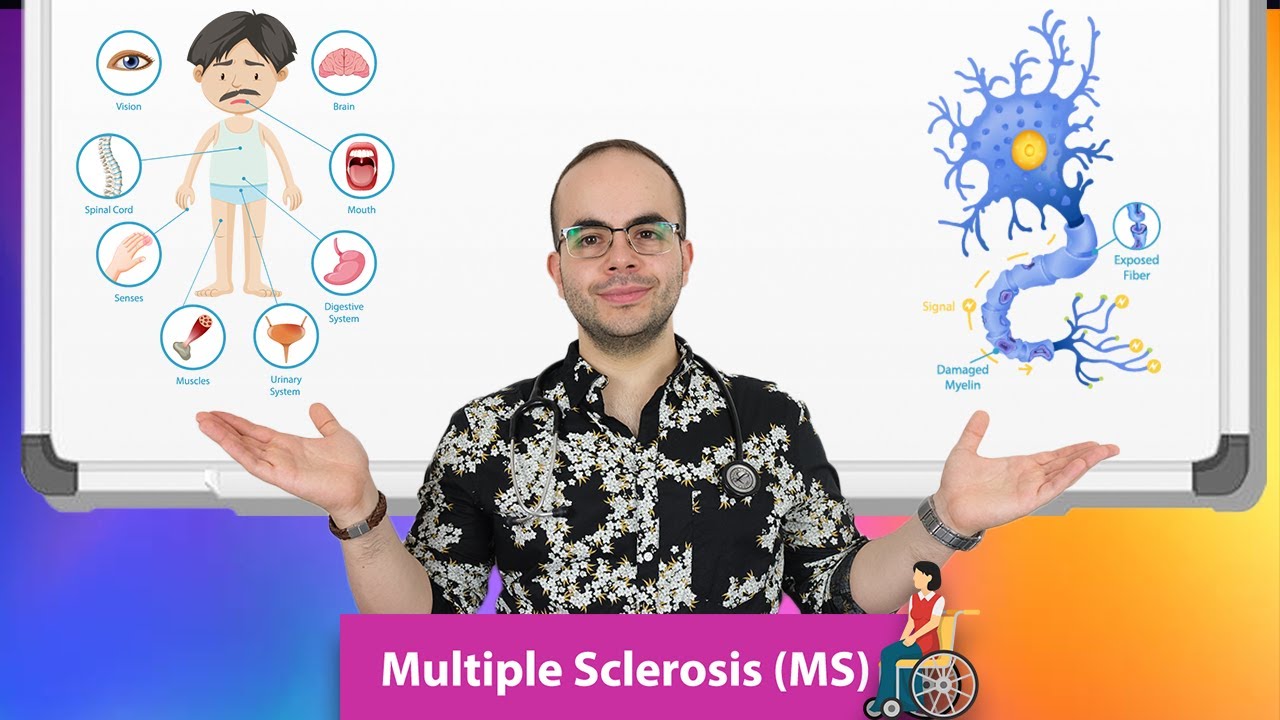 التصلب اللويحي (المرض الغدار)  شرح مبسط - طبيب في السويد Multiple Sclerosis