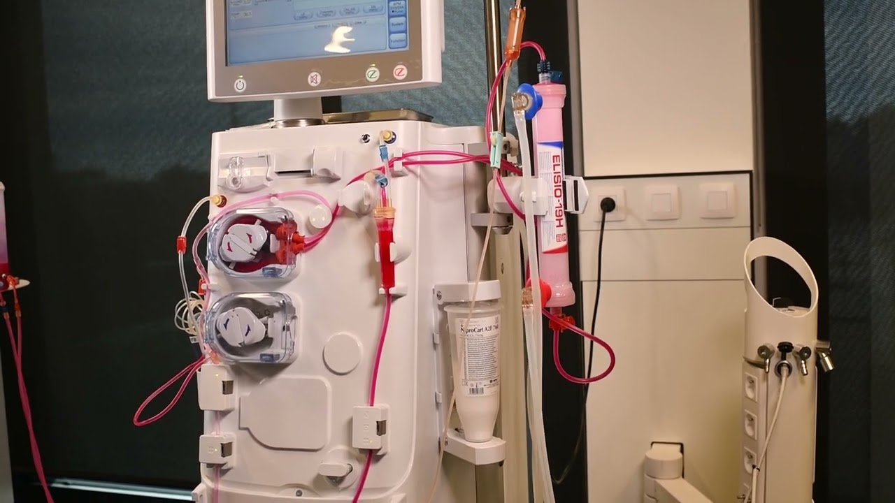 How to perform a treatment interruption and circulation on Surdial X