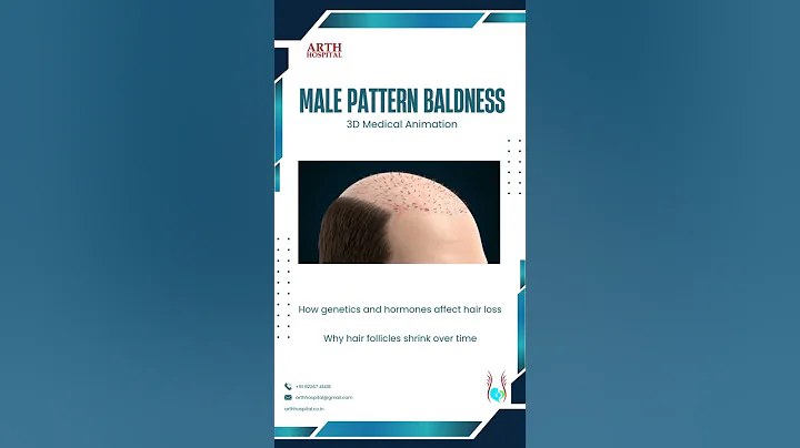 Male Pattern Baldness Explained | Timelapse 3D Medical Animation #shorts