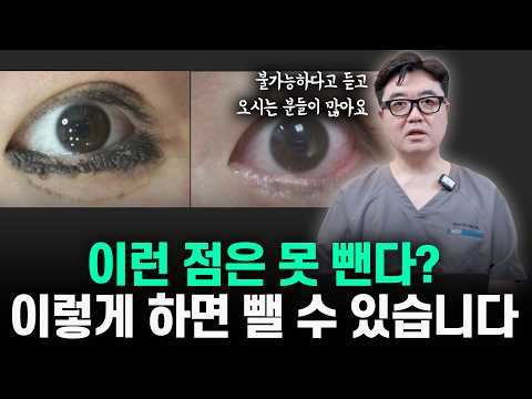 제거가 불가능한 점? 방법이 없는 건 아닙니다.