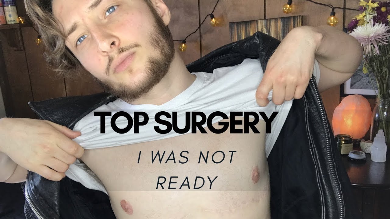 FTM Top Surgery I Wasn't Ready Here's Why. YouTube