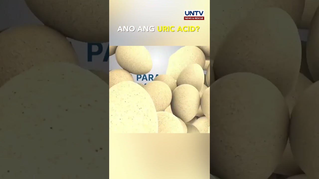 URIC ACID: Mga DAPAT mong MALAMAN