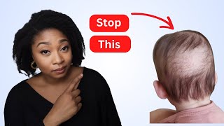 Haircare Mistake That Will RUIN baby Hair causes bald spot and patches