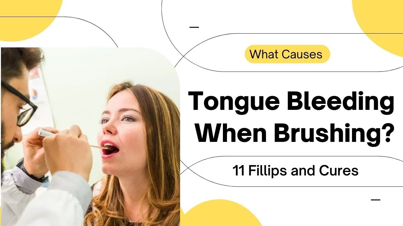 what-causes-tongue-bleeding-when-brushing-11-fillips-and-cures-youtube