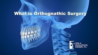 What is Orthognathic surgery, and how can it help patients physically and aesthetically?