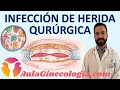 INFECCIÓN DE HERIDA QURÚRGICA: PROFILAXIS, DIAGNÓSTICO, TRATAMIENTO... - Ginecología y Obstetricia -