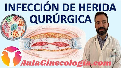 ¿Cuánto tarda en desaparecer la infección de una herida?