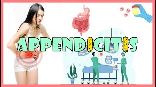 Appendicitis :- Anatomy, Causes, Pathogenesis, Symptoms, Physical Examination, Diagnosis & Treatment