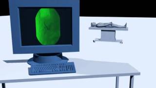 Optibase Applications - Eeg Monitoring