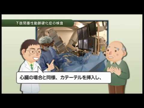 海老名総合病院　心臓血管センター　「下肢閉塞性動脈硬化症」