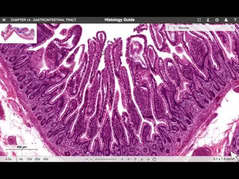 HISTOLOGI (GI-TRACTUS): TYNNTARM (ILEUM)