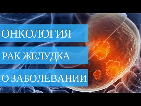 ВСЁ О РАКЕ ЖЕЛУДКА - симптомы, причины, лечение