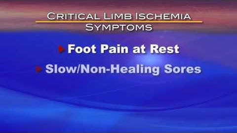 Critical Limb Ischemia