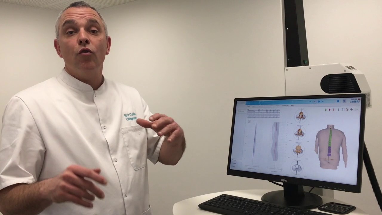 Diers Loopanalyse praktijk Nijmegen