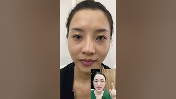 Nâng tầng mặt giữa case điển hình