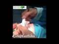 Rinoplastika | Dermolife
