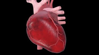 Understanding Heart Disease and Heart Attack Risk | Preventive Cardiology