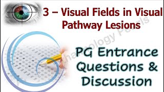 Visual Fields in Visual Pathway Lesions |PG Entrance Questions & Discussion 3