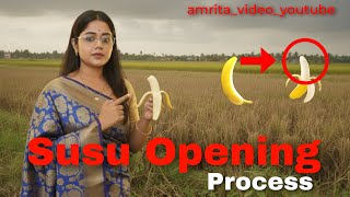 Baby Boy Private Part Open Kaise Kare | How To Open Baby Boy Susu | Phimosis | Baby Boy Susu Opening