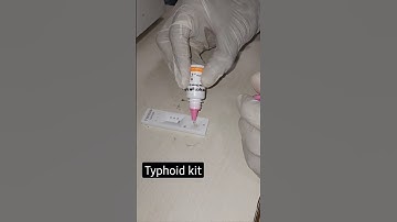 Typhi dot  [IgG & IgM] test procedure 🦠🦠