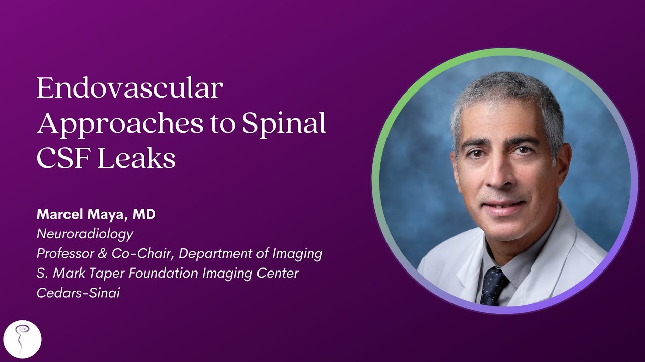 Approach Sb Dr. Marcel Maya—Endovascular Approaches to Spinal CSF Leaks - YouTube