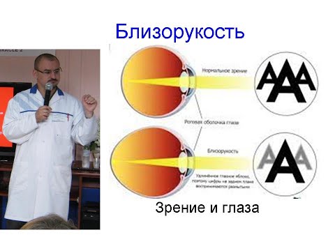 Близорукость. Спазм аккомодации. Минусовые очки.