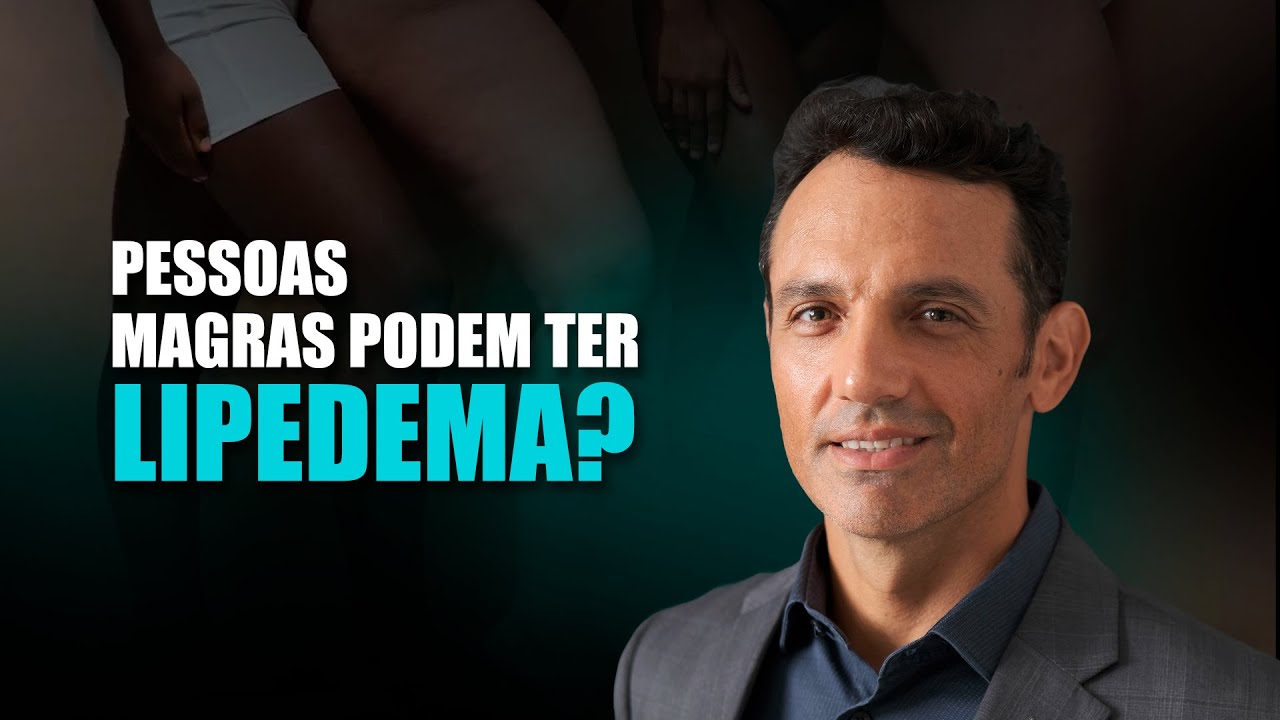 Pessoas Magras Podem ter Lipedema? Dr. Charlston Rodrigues