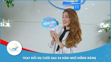 Rạng rỡ sau 24 năm không dám cười – Tháo niềng chữa răng khấp khểnh