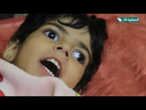 حالة إنسانية | خمسة اطفال يعانون من ضمور دماغي بسبب زواج الاقارب | سنابل الخير