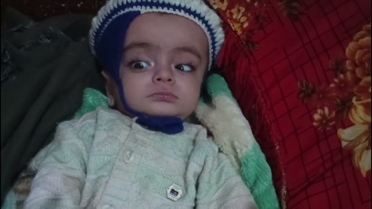 Новости о новой операции малыша Абубакара | Ожидаем результаты анализа спинномозговой жидкости