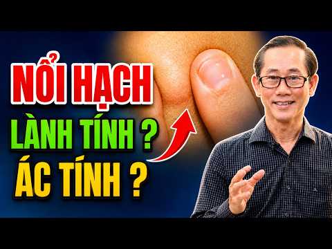 Nổi Hạch: Làm Sao Biết Lành Tính Hay Ác Tính? Dấu Hiệu Phải Đi Khám Ngay