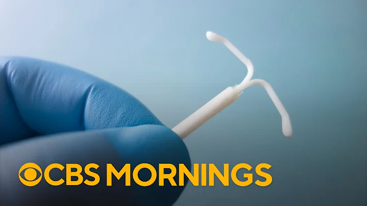 CDC issues new guidelines on pain management for IUD procedures