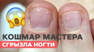 видео: Что делать? Сложные ногти |Преображение обгрызенных ногтей картинка: Что делать? Сложные ногти |Преображение обгрызенных ногтей