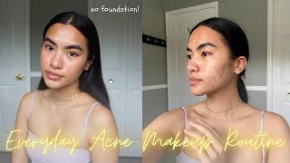 natural everyday acne makeup routine (for acne, textured skin & post inflammatory pigmentation) screenshot 4